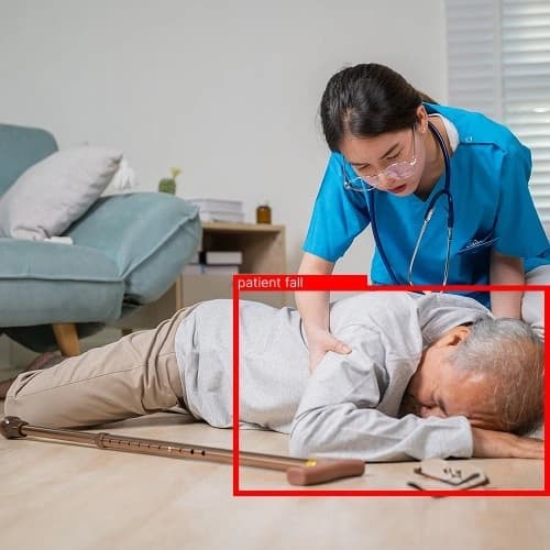 Patient fall detection and prevention