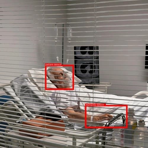 ICU and high-risk patient monitoring